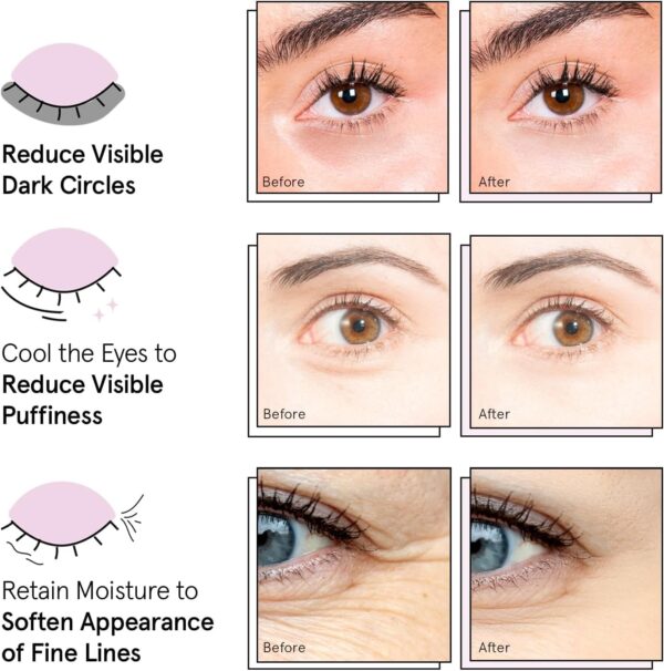 grace & stella Under Eye Mask - Gifts for Women - Reduce Dark Circles, Puffy Eyes, Undereye Bags, Wrinkles - Overnight Gel Under Eye Patches - Bridesmaid Gifts - Vegan Self Care (24 Pairs, Gold) - Image 2