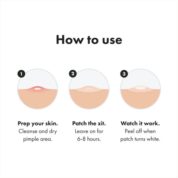 Mighty Patch™ Original patch from Hero Cosmetics - Hydrocolloid Acne Pimple Patch for Covering Zits and Blemishes in Face and Skin, Vegan-friendly and Not Tested on Animals (36 Count) - Image 6
