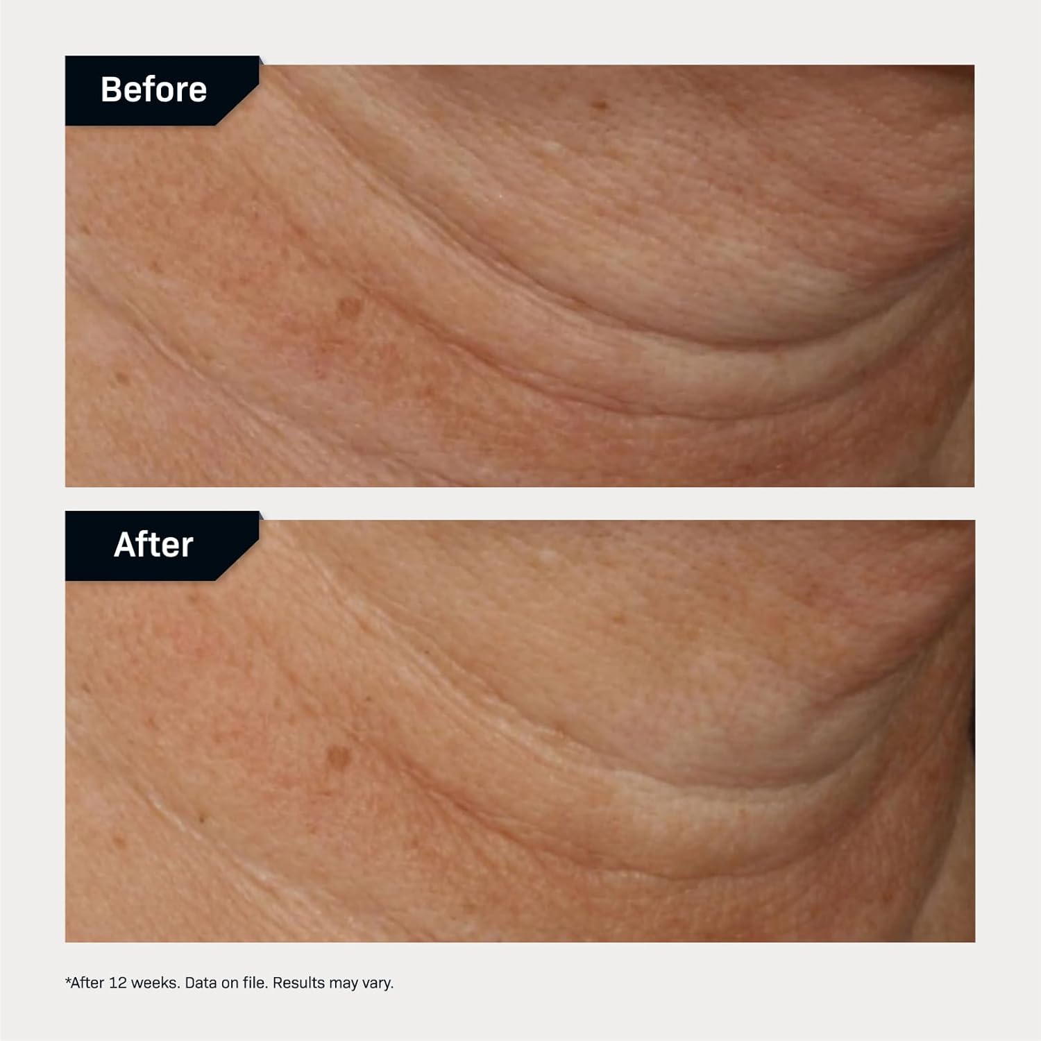 Revision Skincare Nectifirm® Advanced, Anti Aging Neck Firming Cream with Peptides for Fine Lines, Wrinkles and Crepey Skin - Image 5