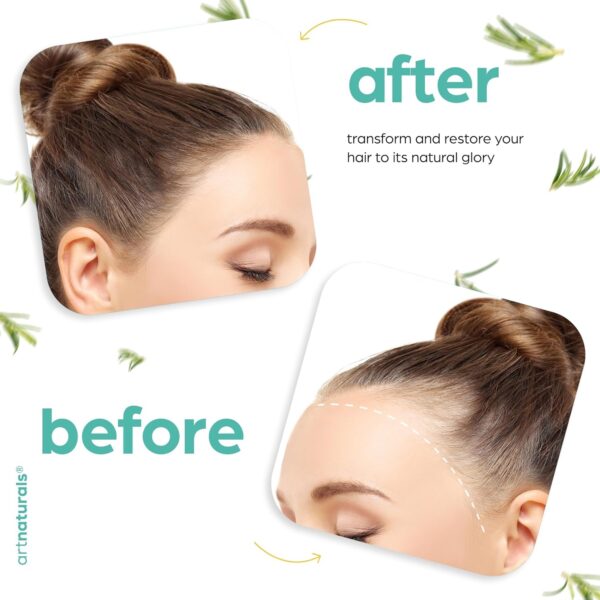 ArtNaturals Organic Rosemary & Castor Hair Growth Oil + Scalp Massager Set – Hair Styling Oils for Dry, Itchy Scalp, Thickening & Hydration - Scalp Oil Products For Damaged Hair & Split Ends – 4.0 oz - Image 7