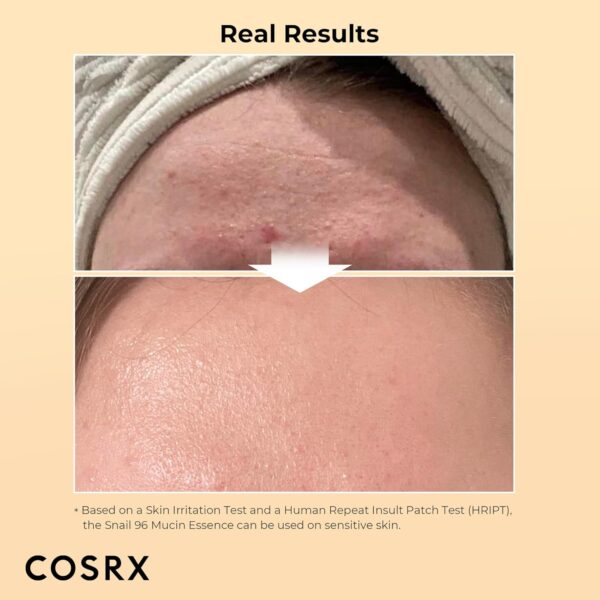 COSRX Snail Mucin 96% Power Repairing Essence 3.38 fl.oz 100ml, Hydrating Serum for Face with Snail Secretion Filtrate for Dull Skin & Fine Lines, Korean Skin Care - Image 2