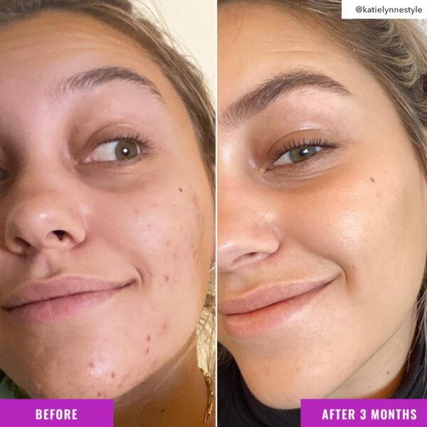 Good Molecules Niacinamide Brightening Toner - Facial Toner with Niacinamide, Vitamin C and Arbutin for Even Tone, Enlarged Pores - Skincare for Face - Image 5