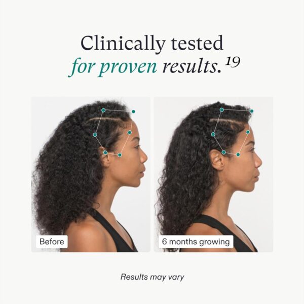 Nutrafol Women's Hair Growth Supplements, For Women 18-44 Years Old, Clinically Tested for Visibly Thicker, Stronger Hair, 100% Vegan Ingredients, Dermatologist Recommended - 1 Month Supply - Image 4