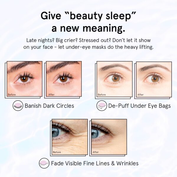 grace & stella Under Eye Patches for Puffy Eyes and Dark Circles (Retinol, 24 Pairs) Restoring Gel Under Eye Masks with Hyaluronic Acid - Vegan Cruelty-Free Skincare Birthday Gifts for Women - Image 2