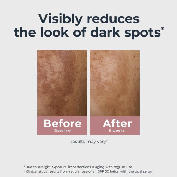 Eucerin Radiant Tone Dual Serum Dark Spot Corrector, Dark Spot Serum with Thiamidol and Hyaluronic Acid, Helps Visibly Reduce the Look of Persistent Dark Spots, 1 Fl Oz Bottle - Image 4