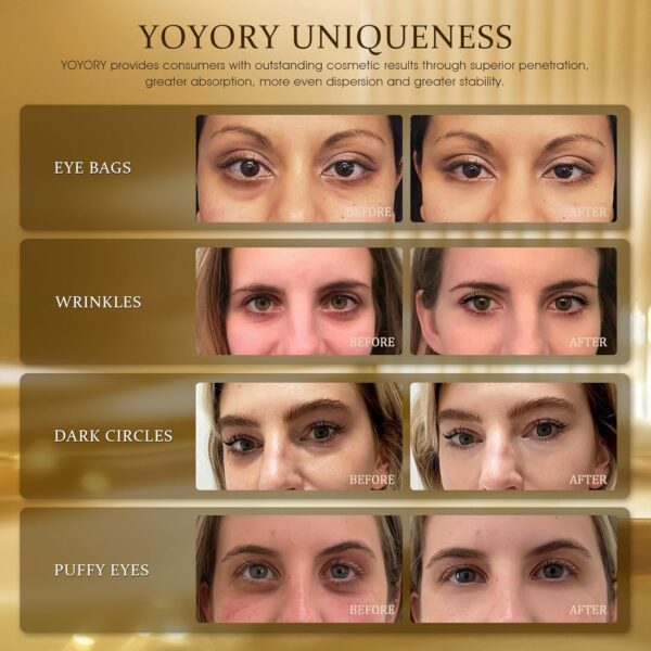Under Eye Patches Masks - Collagen & Hyaluronic Acid for Removing Eye bags, Puffiness, Dark Circles Smoothing Skin Care Treatment for Women and Men, (60 Pcs) Gold - Image 2