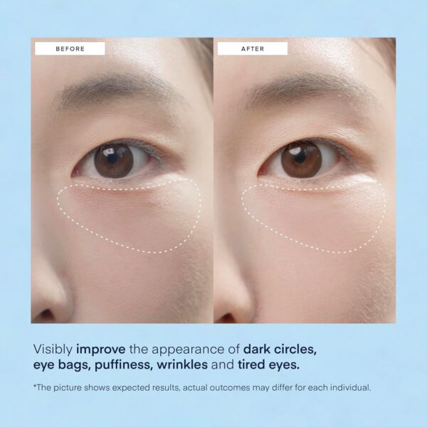 Under Eye Patches for Dark Circles: Puffiness & Eye Bag Treatment Gel Mask with Caffeine Hyaluronic Acid Niacinamide - Undereye Brightening Hydrating Anti-Wrinkle & Cooling - Korean Skincare, 30 Pairs - Image 4