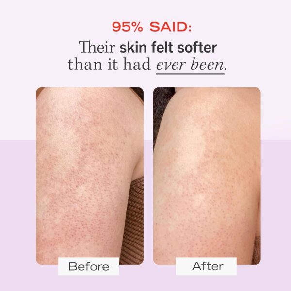 First Aid Beauty - KP Bump Eraser Body Scrub with 10% AHA, Keratosis Pilaris Skin Exfoliator with Glycolic and Lactic acids, Helps Reduce Chicken Skin Bumps, Safe for Sensitive Skin, 2 oz - Image 3