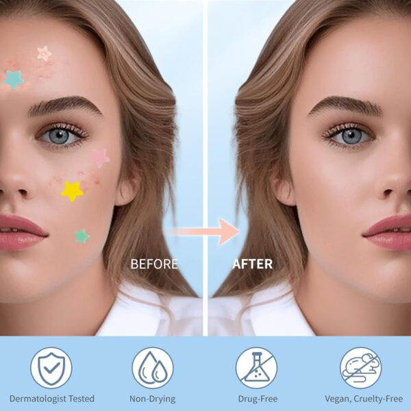 Pimple Patches for Face, Hydrocolloid Acne Patches, Cute Star Zit Covers, Colorful Spot Stickers with Tea Tree, Salicylic Acid & Cica Oil| 3 Sizes (10mm, 12mm & 14mm) |200 Count - Image 4