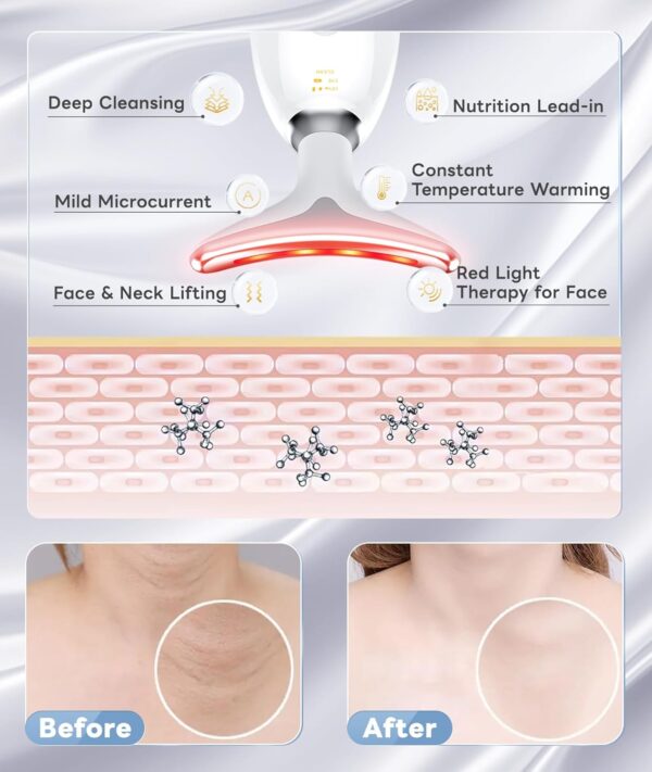 Light Based Multifunctional Facial Massager, 7 Color Portable Face Massager Tool for Skin Care, Glossy White - Image 4