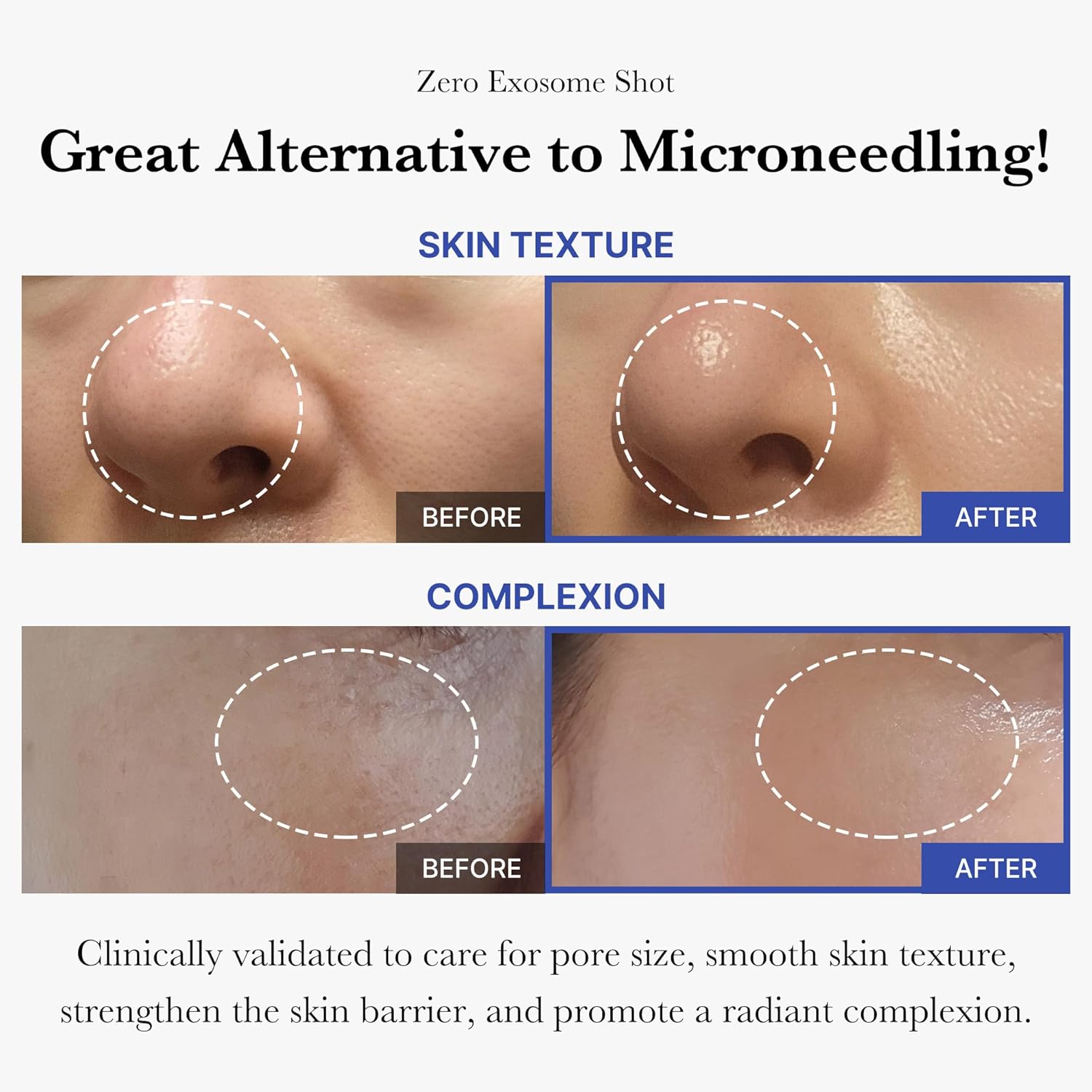 medicube Zero Exosome Shot 2,000 PPM Spicule Facial Serum | Liquid Skin Booster Serum | Exosome, AHA+BHA+PHA | Pore Care, Dead Skin Cells, Skin Texture | Korean Skin Care 1.01 fl.oz - Image 2