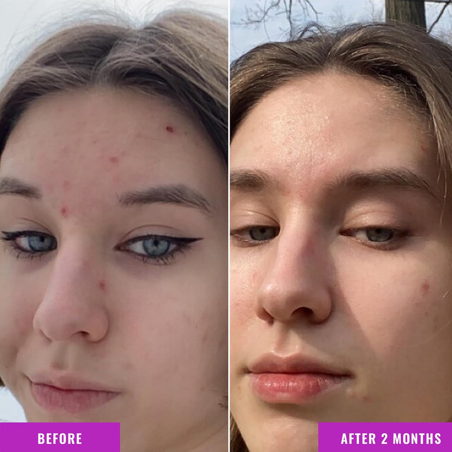 Good Molecules Niacinamide Serum - 10% Niacinamide Balancing B3 Facial Serum for Acne, Tone, Texture - Brightening and Hydrating Skincare for Face - Image 4