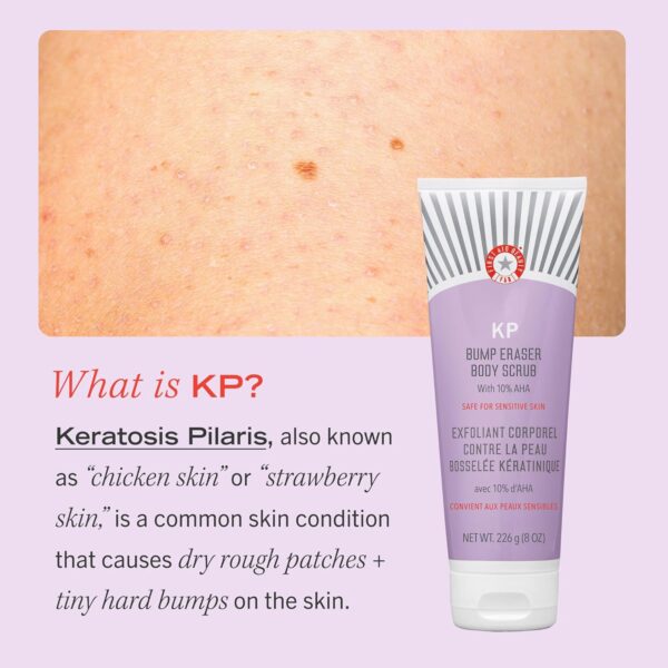 First Aid Beauty - KP Bump Eraser Body Scrub with 10% AHA, Keratosis Pilaris Skin Exfoliator with Glycolic and Lactic acids, Helps Reduce Chicken Skin Bumps, Safe for Sensitive Skin, 2 oz - Image 6