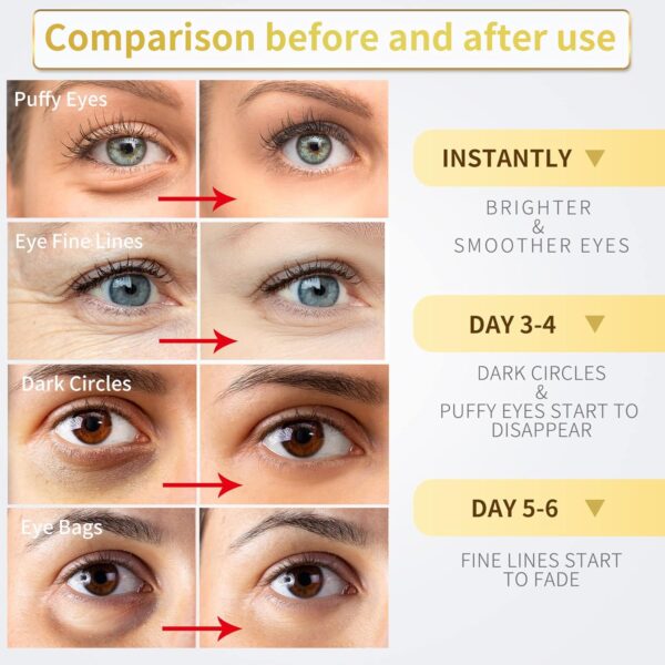 Under Eye Patches - 60 Pcs - 24K Gold Eye Mask- Puffy Eyes & Dark Circles Treatments,Reduce Under Eye Bags and Smooth Wrinkles,Eye Skin Care Pads With Collagen,Hyaluronic Acid & Castor Oil - Image 3