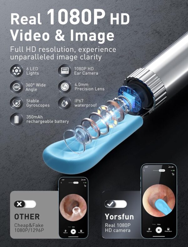 Ear Wax Removal - 3 in 1 Wireless WiFi Rechargeable Ear Cleaner, FSA Eligible Items Only List, 1080P HD Camera Lens & 7 Pcs Ear Set, Ear Cleaning Kit with 15 Replacement Tips, Black - Image 3