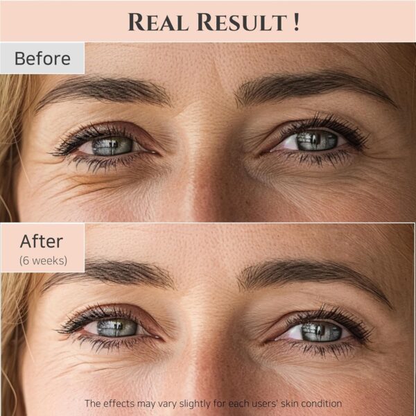 Beauty of Joseon Revive Eye Serum with Retinal Niacinamide Correction for Puffy Eye Bags Fine Lines Dark Circles Wrinkles, Korean Skin Care 30ml, 1 fl.oz, 2 Packs - Image 5