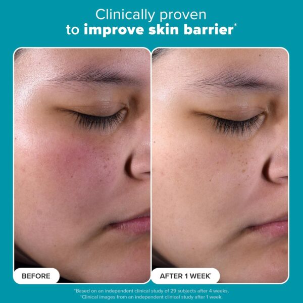 Paula's Choice SKIN PERFECTING 2% BHA Liquid Salicylic Acid Exfoliant-Facial Exfoliant for Blackheads, Enlarged Pores, Wrinkles & Fine Lines - Image 4