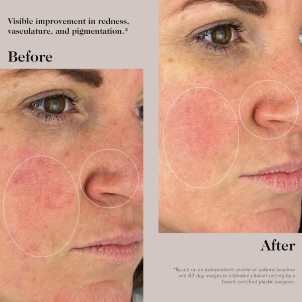 goop Beauty Peptide Serum |Reduces Fine Lines, Wrinkles, & Dark Spots | Peptides, Ceramides, & Niacinamide | Anti Aging Treatment to Improve Firmness & Elasticity | 1 fl oz - Image 5